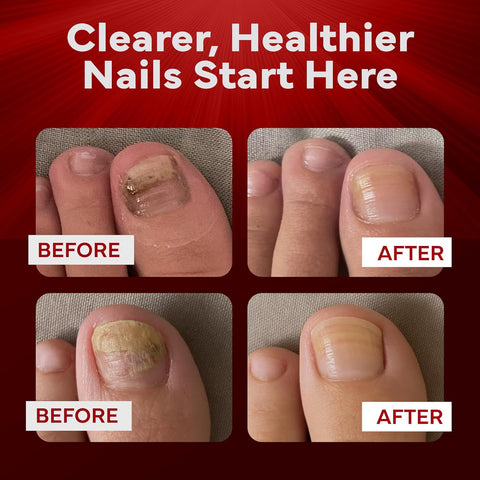 EMUAIDMAX Nail Care Ointment